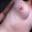 Prev