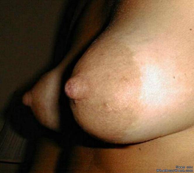 Puffy Areola Pictures