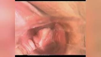 video of Insertion  Speculum Camera Inside Vagina