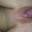 Prev